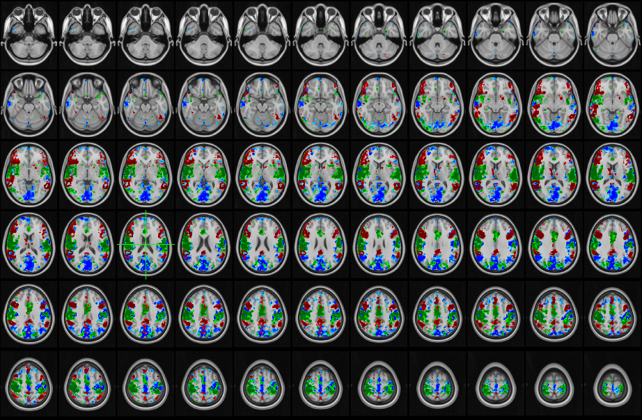 Resting state fMRI emotion tracking
